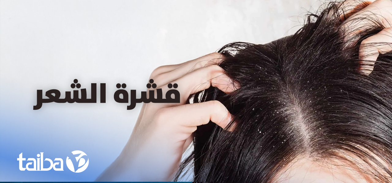 Dandruff… Causes and How to Get Rid of It